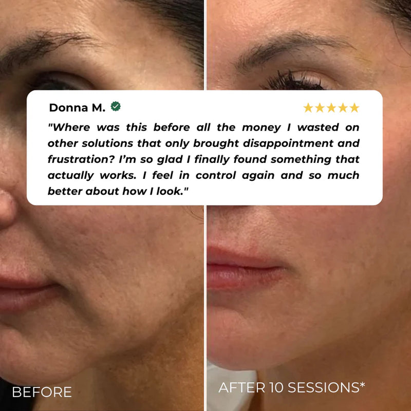 Nuvio EMS Patch Full Face Set