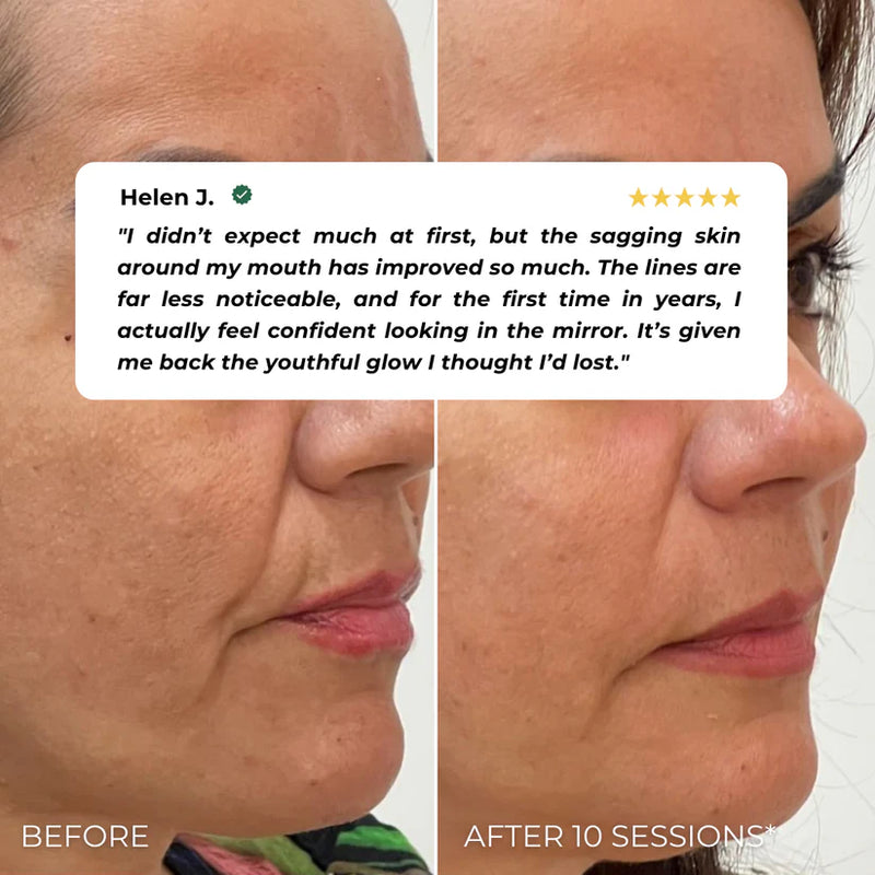 Nuvio EMS Patch Full Face Set