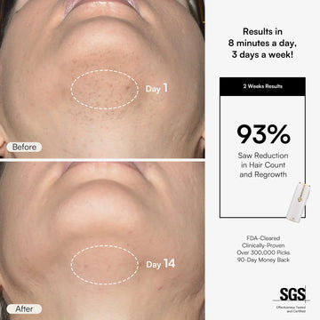 Nuvio IPL Hair Removal Device