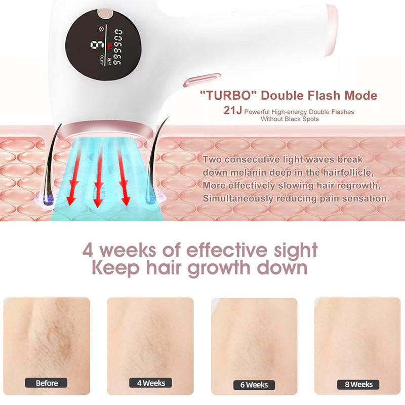 SmoothSkin™ – IPL Laser Hair Removal Device